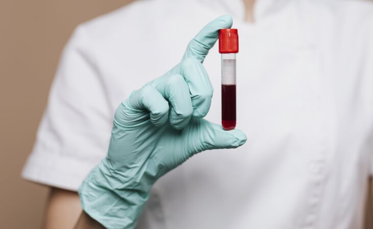 Artykuł o badaniu na miażdżycę